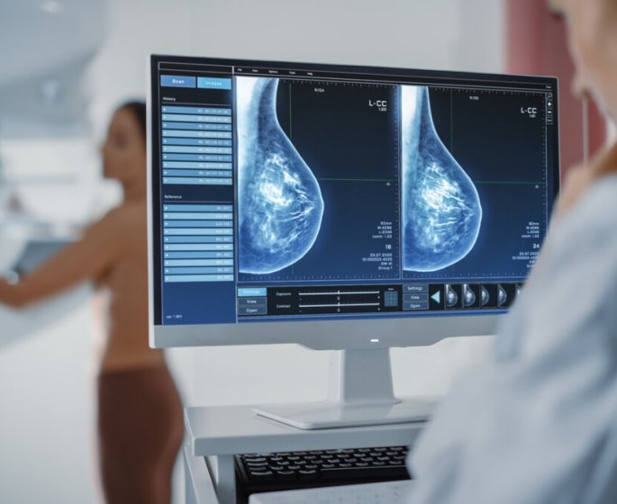 Cancer du sein : la mammographie est-elle efficace apres 75 ans ?