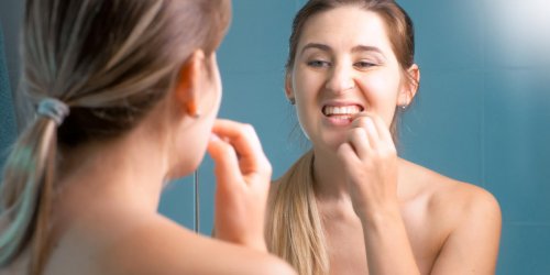 Dechaussement dentaire : reconnaitre les signes avant-coureurs