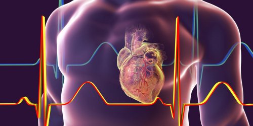 Insuffisance cardiaque droite : comment la reconnaitre