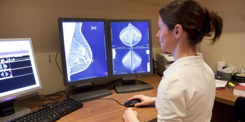 Un cancer du sein avancé guéri grâce à une thérapie stimulant le système immunitaire