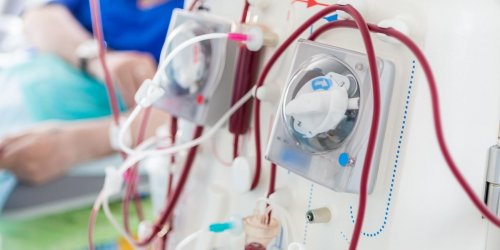 Reins : alerte sur un produit de dialyse qui aurait pu causer des deces prematures